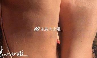 微密圈 - 宸大小姐的更新——白丝来了，居然还有这种穿法？太会玩了！